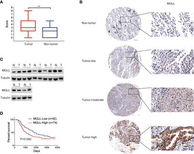 Monoacylglycerol Lipase Knockdown Inhibits Cell Proliferation and Metastasis in Lung Adenocarcinoma